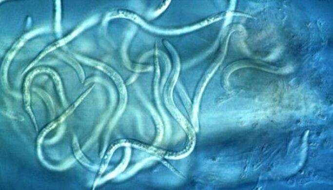 how nematode parasites look in the human body