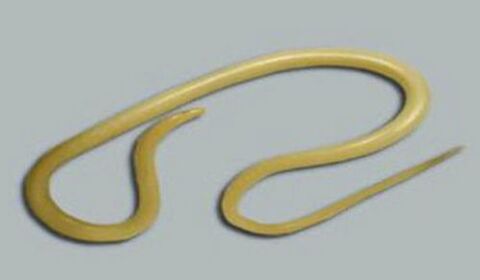 a roundworm from the human body