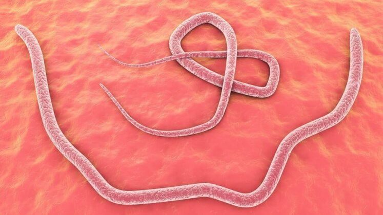 a roundworm in the human body